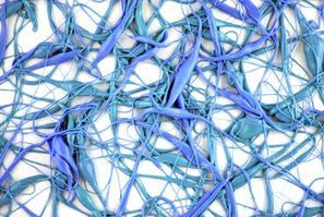Видове изкуствени невронни мрежи
